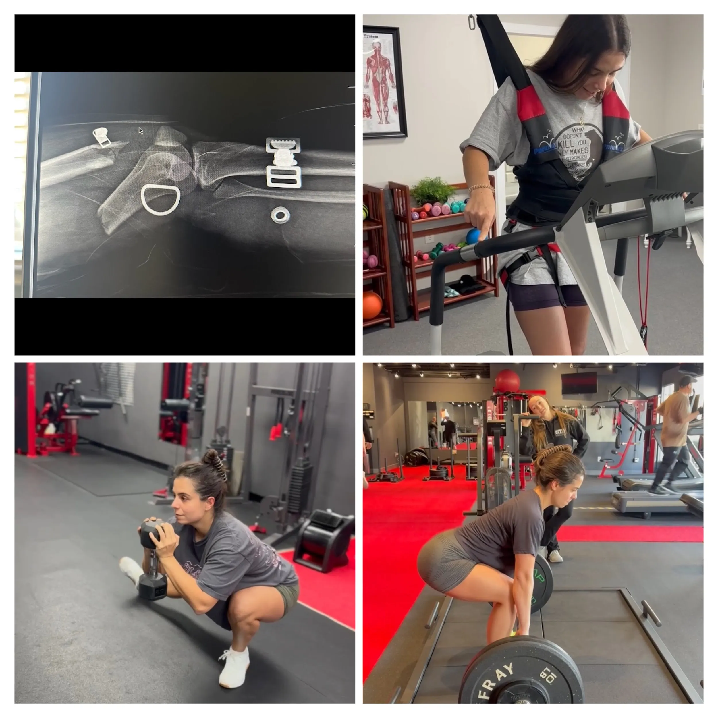 darwin fitness older adult client training to fight arthritis