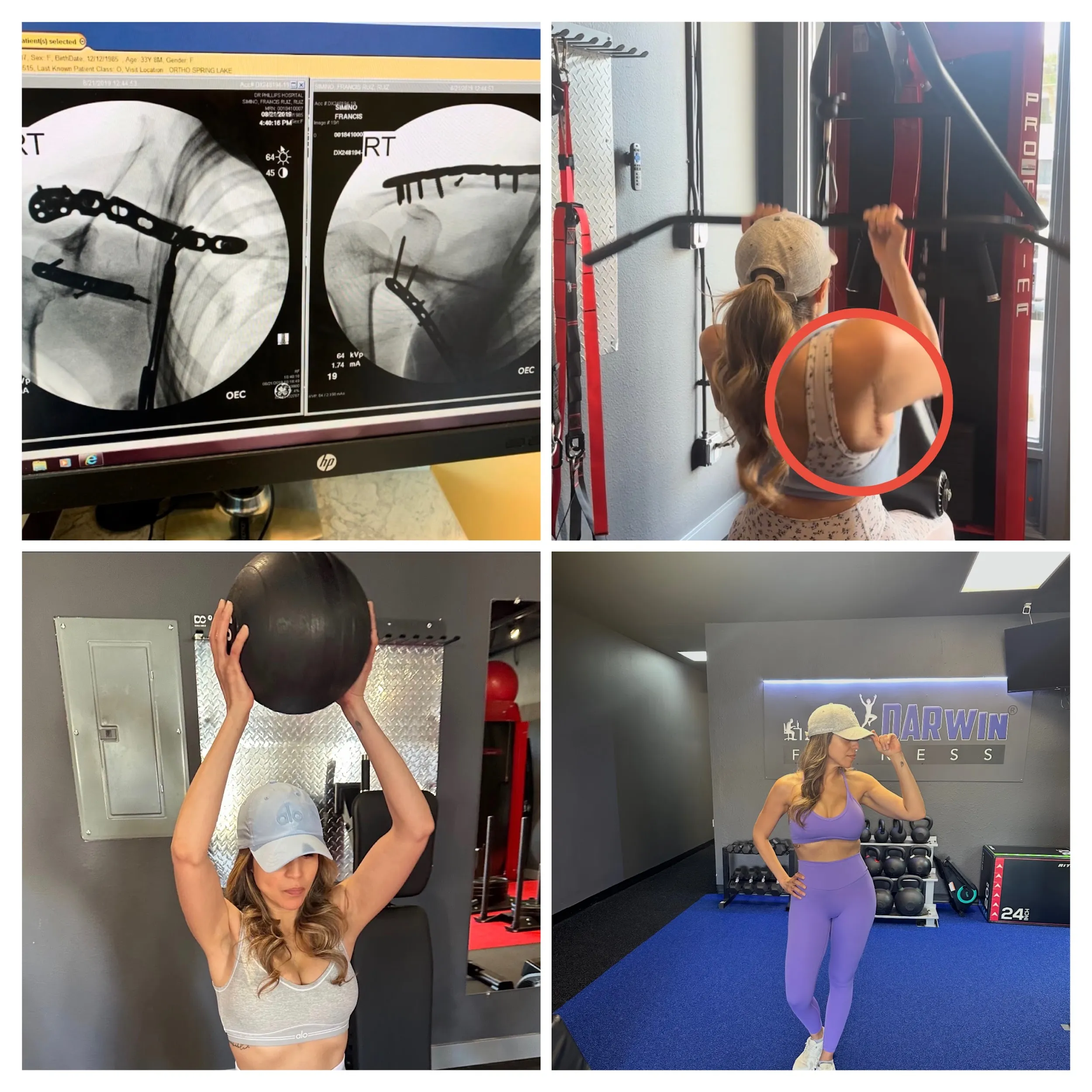 darwin fitness older adult client training to fight arthritis